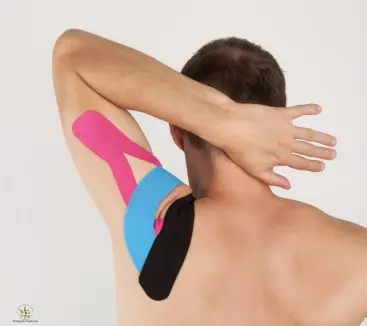 Kinesiotaping (Kinesiology Tape) applied on the shoulder and upper back for muscle support and pain relief at Advance Physiotherapy Clinic, Chhatrapati Sambhajinagar (Aurangabad)