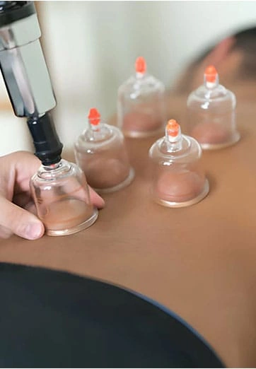 Cupping therapy for muscle pain and recovery