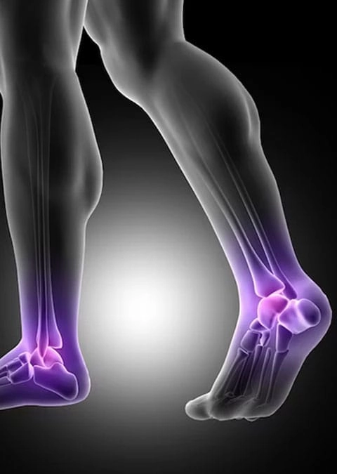 Heel pain physiotherapy treatment session