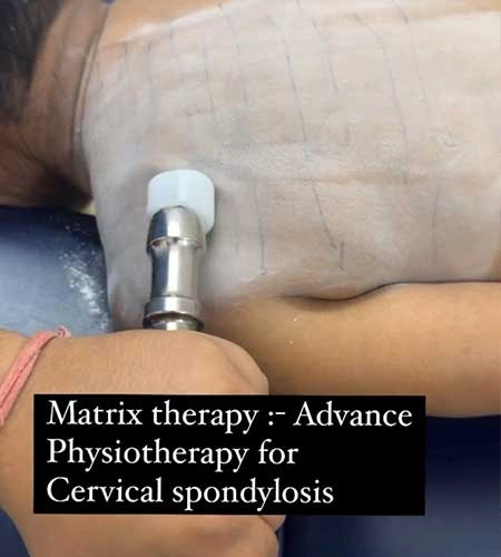 Matrix Rhythm Therapy for cervical spondylosis treatment